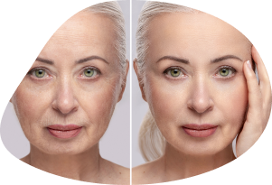 peptides skincare anti-aging