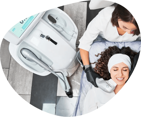 acne scar subcision treatment