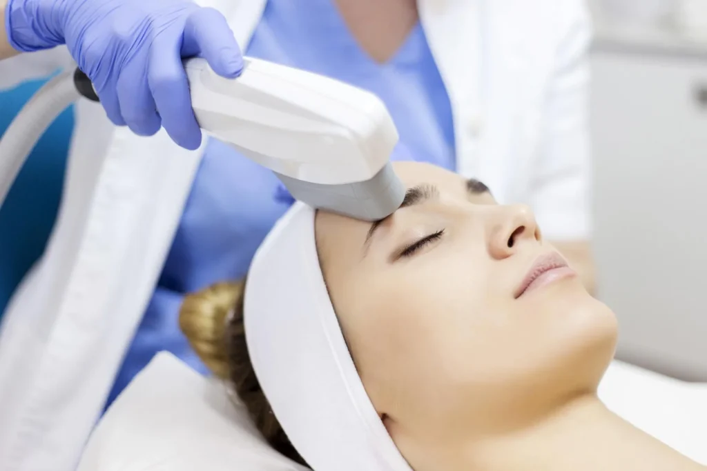 microneedling facial treatment