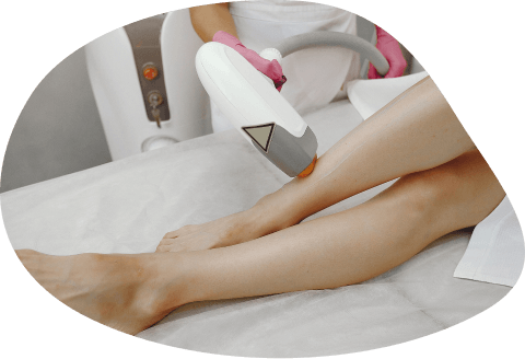 Leg Laser Hair Removal in Arlington Heights, IL